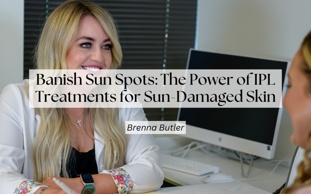 Sun Spot Removal with IPL in Boise ID