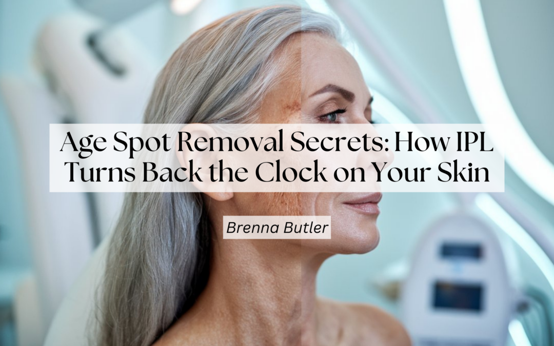 Age Spot Removal Boise ID