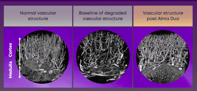 Solutions for Painful Intimacy: The Role of Hormones and Laser Treatment