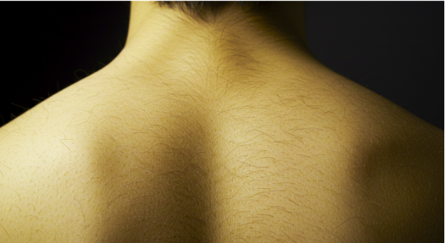 Where Laser Hair Removal Works Best: 9 Popular Treatment Areas