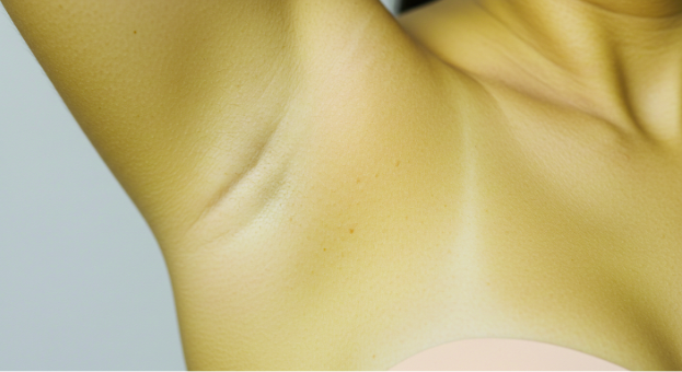 Where Laser Hair Removal Works Best: 9 Popular Treatment Areas