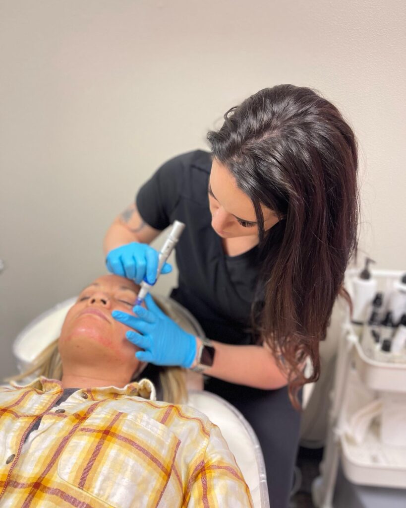 SkinPen Microneedling in Boise, ID